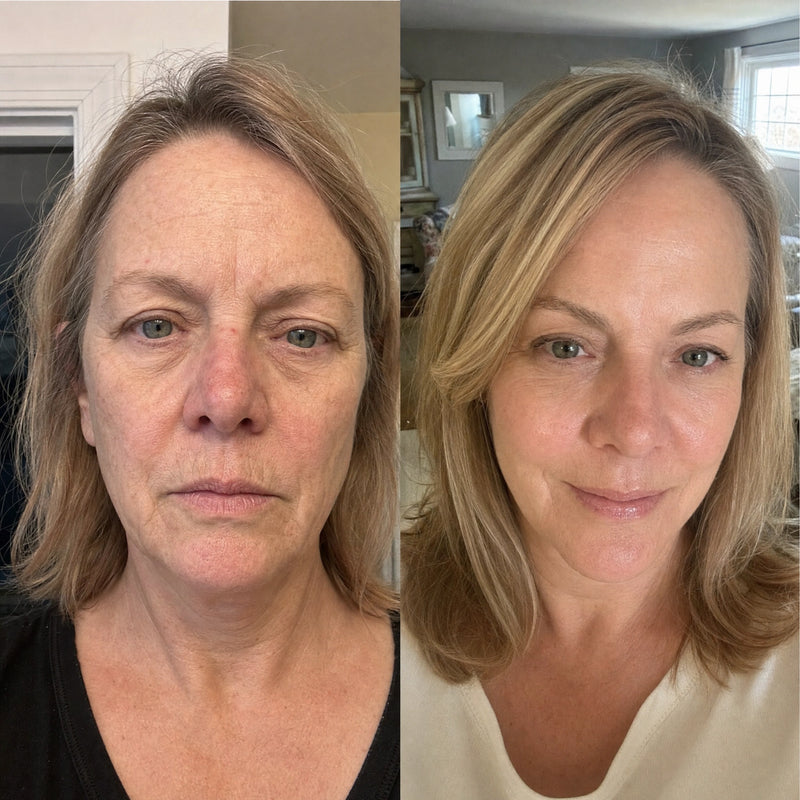 Revitalized Texture & Glow