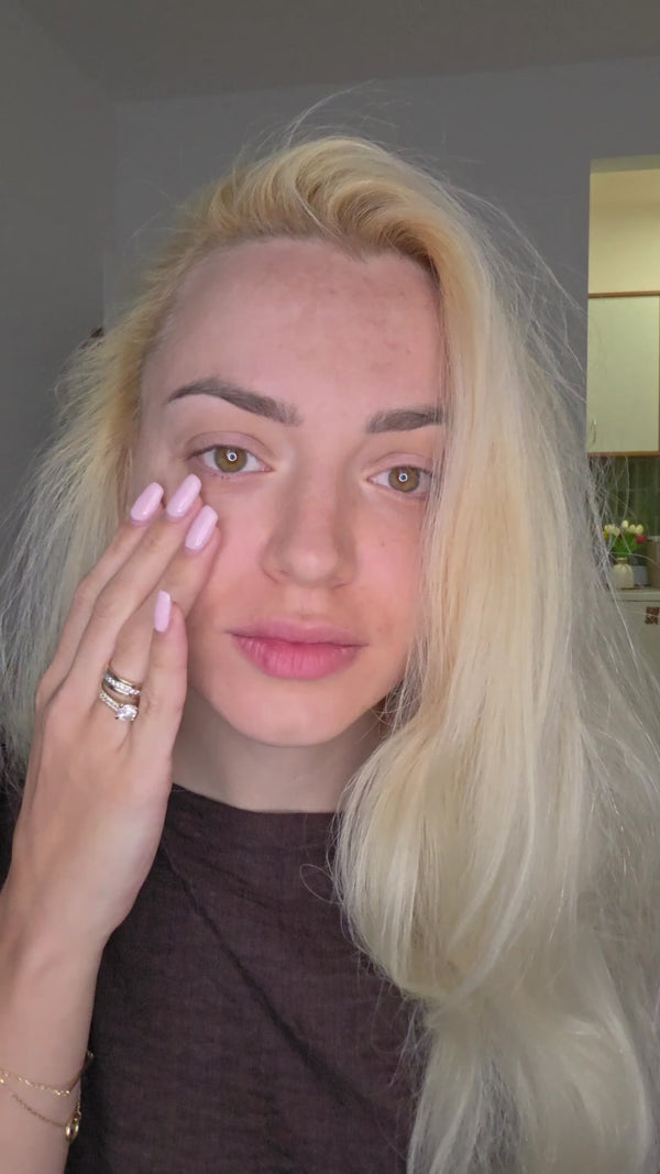 Botox kod kuće